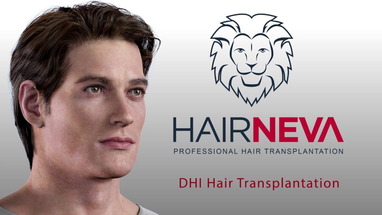 DHI Hair Transplantation maxresdefault