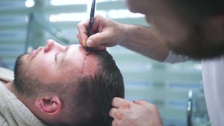 Hair Styling After Hair Transplant